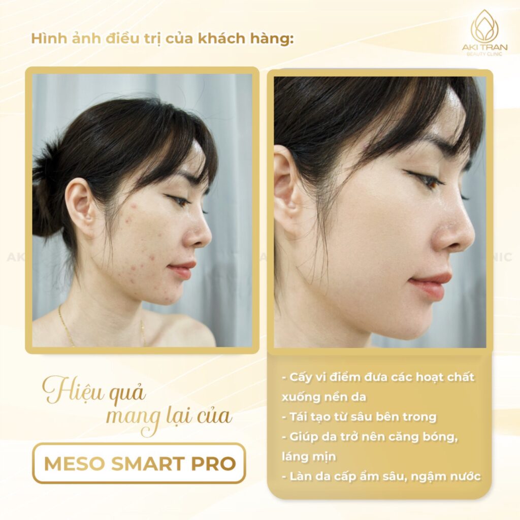 Aki Trần Beauty